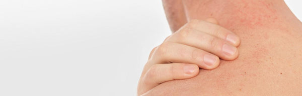 Dry to atopic skin