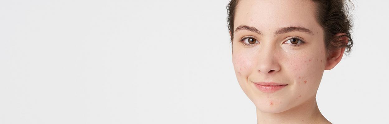 Combination, oily to acne-prone skin